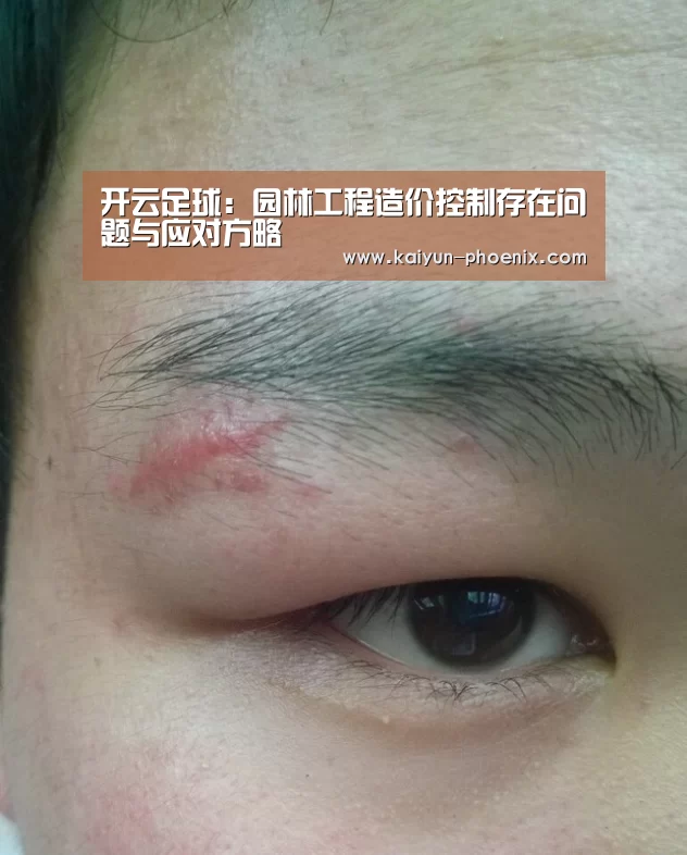 开云足球:园林工程造价控制存在问题与应对方略(图1) 开云赛事